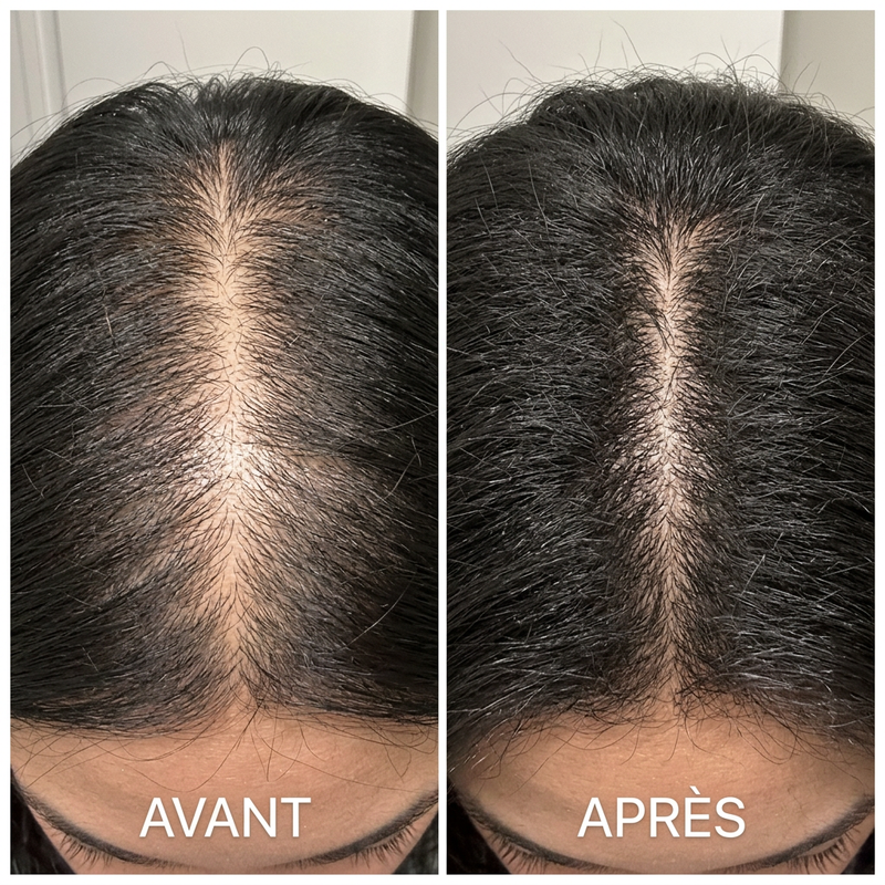 Avant/Après Mélissa, 34 ans