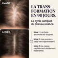 Sérum de Pousse - Efficacité prouvée cliniquement